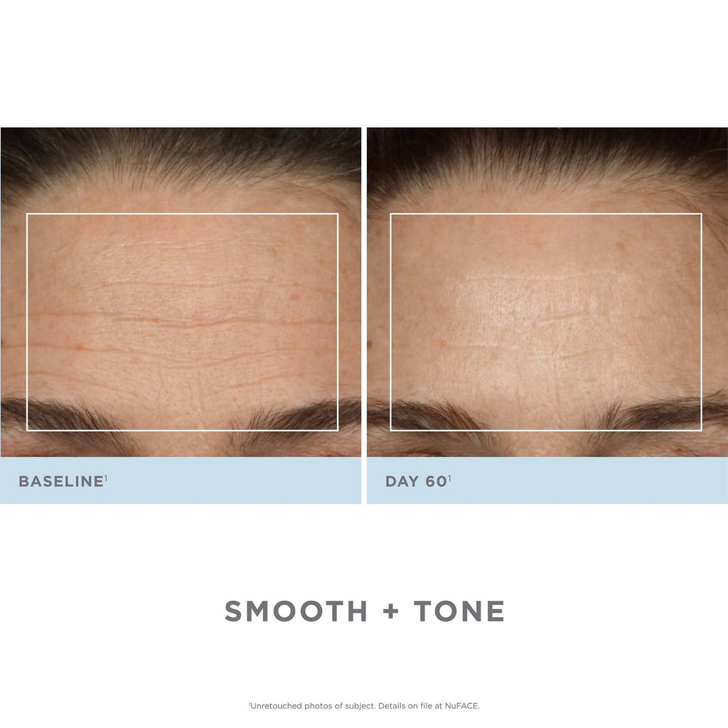 Facial Toning Kit A8958