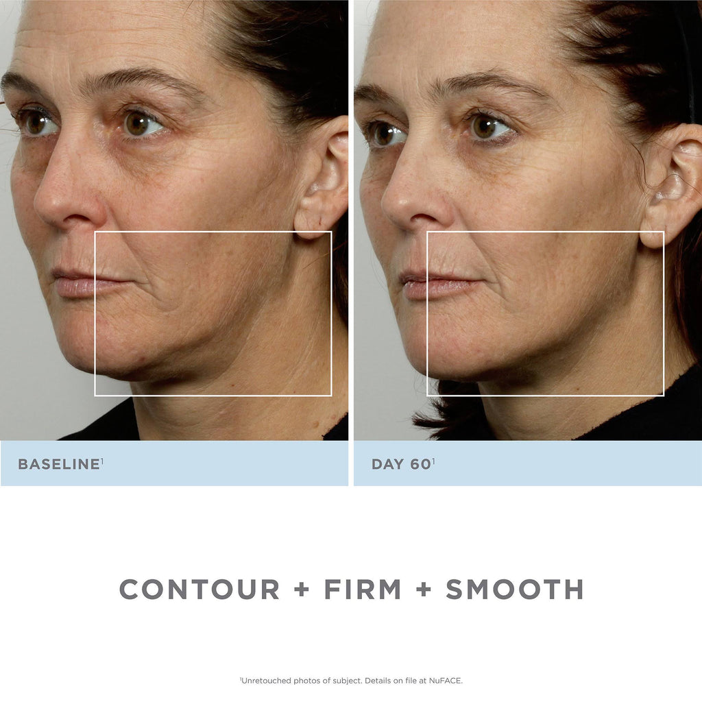 Facial Toning Kit A8958